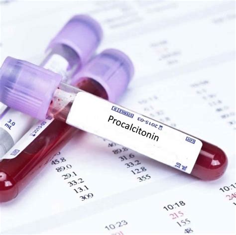 what does procalcitonin measure|Procalcitonin Test: MedlinePlus Medical Test.